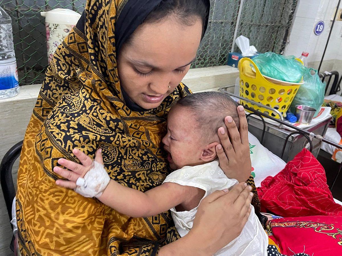 হামের সঙ্গে নিউমোনিয়ার জটিলতা, দূরদূরান্তের শিশুদের শেষ ভরসা ঢাকা